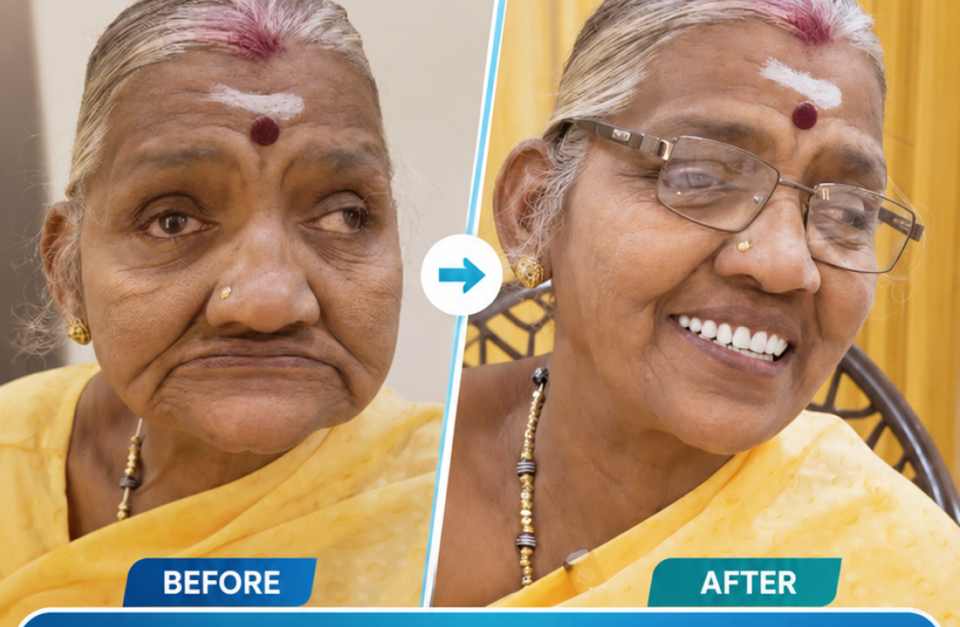 Dental Implants in Tirunelveli