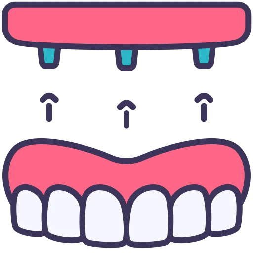 Natural dental implants