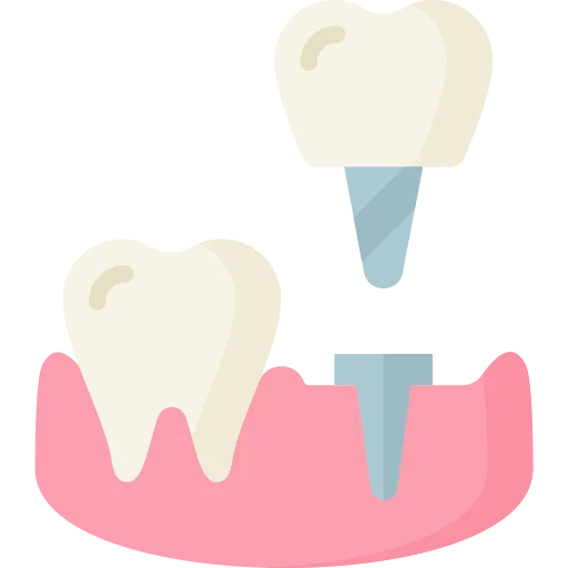 Dental implants