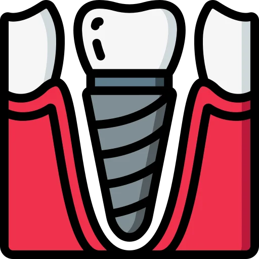 Dental implants jawbone support